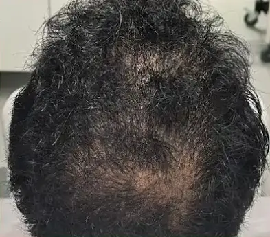 قبل